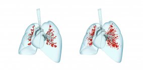 Infecção pulmonar viral, ilustração. Pulmões inflamados infectados com partículas virais. — Fotografia de Stock