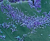 Las bacterias vaginales. Micrografía electrónica de barrido coloreada (SEM) de bacterias en la pared vaginal. Una flora vaginal saludable protege el cuerpo contra las infecciones urogenitales - foto de stock