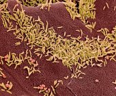 Bactéria vaginal. Micrografia eletrônica de varredura colorida (MEV) de bactérias na parede vaginal. Uma flora vaginal saudável protege o corpo contra infecções urogenitais — Fotografia de Stock