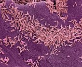 Las bacterias vaginales. Micrografía electrónica de barrido coloreada (SEM) de bacterias en la pared vaginal. Una flora vaginal saludable protege el cuerpo contra las infecciones urogenitales - foto de stock