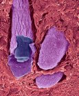 Hair follicles. Coloured scanning electron micrograph (SEM). The outer layer of hair (the cuticle) has overlapping scales of keratin. These scales are thought to prevent hairs from matting together — Stock Photo
