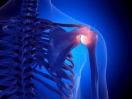 Painful shoulder joint, computer illustration — Stock Photo