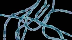 Anthrax bacteria, illustration. Anthrax bacteria (Bacillus anthracis) are the cause of the disease anthrax in humans and livestock. They are gram-positive spore producing bacteria arranged in chains (streptobacilli). Many cells have a central spore. — Stock Photo