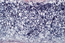 Sezione trasversale della cartilagine umana e dell'osso, micrografo leggero. Macchia di ematossilina ed eosina. — Foto stock