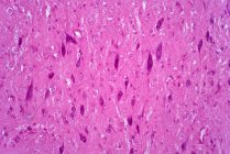 Motoneuroni, micrografo leggero. I motoneuroni del midollo spinale fanno parte del sistema nervoso centrale. Macchia di ematossilina ed eosina. — Foto stock