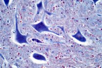 Motoneuroni, micrografo leggero. I motoneuroni del midollo spinale fanno parte del sistema nervoso centrale. Macchia di ematossilina ed eosina. — Foto stock
