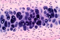Cartilagine umana, micrografo leggero. Sezione trasversale dell'osso cartilagineo umano. Macchia di ematossilina ed eosina. — Foto stock