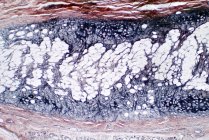Leichte Mikrographie eines Querschnitts aus menschlichem Knorpel und Knochen. Hämatoxylin und Eosin-Fleck. — Stockfoto