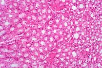 Human kidney tissue, light micrograph. Haematoxylin and eosin stain. — Stock Photo
