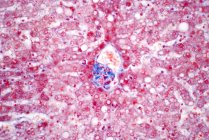Cellules hépatocytaires, micrographie photonique. Les cellules hépatocytaires sont les principales cellules du tissu parenchymateux du foie. Tache d'hématoxyline et d'éosine. — Photo de stock