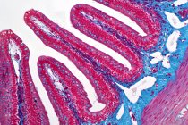 Lichtmikroskopie einer Darmbiopsie aus einer Koloskopie. Der Pathologiebericht beschreibt ein normales Fragment der Darmschleimhaut mit Koliken. Hämatoxylin und Eosin-Fleck. — Stockfoto