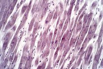 Human cardiac tissue, light micrograph. Haematoxylin and eosin stain. — Stock Photo