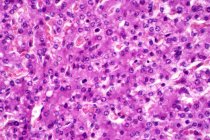 Células hepatocitarias, micrografía ligera. Las células hepatocitarias son las principales células del tejido parenquimatoso del hígado. Tinción de hematoxilina y eosina. - foto de stock