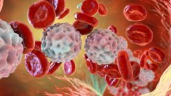 Ілюстрація лімфоцитозу, що показує велику кількість білих кров'яних клітин всередині кровоносних судин . — стокове фото
