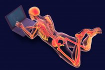 Компьютерная иллюстрация, показывающая мужское тело с плохой осанкой во время работы над ноутбуком. — стоковое фото