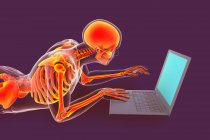 Computerillustration, die einen männlichen Körper mit schlechter Haltung während der Arbeit an einem Laptop zeigt. — Stockfoto
