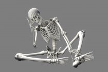 Dolor de cabeza, ilustración por computadora. Un cuerpo masculino, con esqueleto, sosteniendo su cabeza con dolor - foto de stock