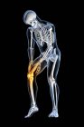 Dolor de rodilla humano, ilustración por computadora. - foto de stock