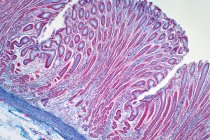 Micrographie photonique d'une biopsie du côlon par coloscopie. Le rapport de pathologie décrit un fragment normal de muqueuse colique avec des glandes coliques. Tache d'hématoxyline et d'éosine. — Photo de stock