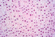 Лёгкий микрограф клеток наконечника лука (Allium cepa), подвергающихся митозу (ядерное деление)). — стоковое фото
