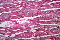 Leichte mikroskopische Aufnahme der Herzmuskulatur. Hämatoxylin und Eosin-Fleck. — Stockfoto
