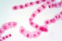 Lichtmikroskopie von Zwiebel- (Allium cepa) Wurzelspitzenzellen, die einer Mitose (Kernteilung) unterzogen werden). — Stockfoto
