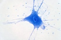 Light micrograph of nerve cells. — Stock Photo