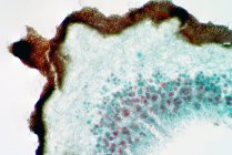 Световая микрография, показывающая поперечное сечение лишайника и грибов. — стоковое фото