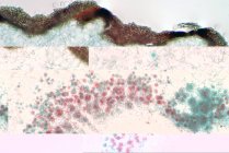 Световая микрография, показывающая поперечное сечение лишайника и грибов. — стоковое фото