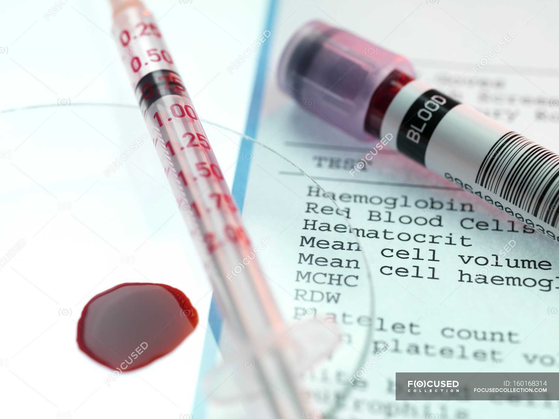 Worden Winderig Interactie Blood test kit and and analysis results — close, up - Stock Photo |  #160168314
