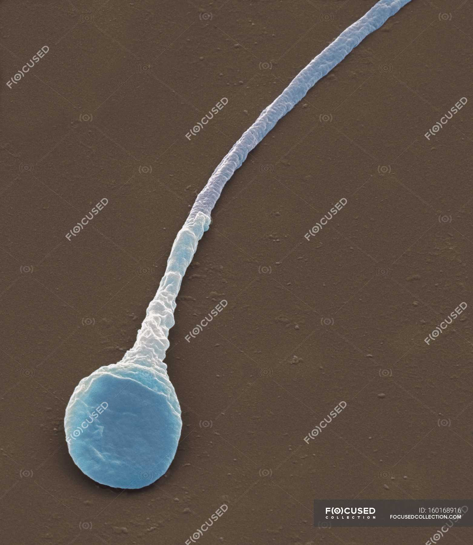 Scanning Electron Microscope Sperm Cells