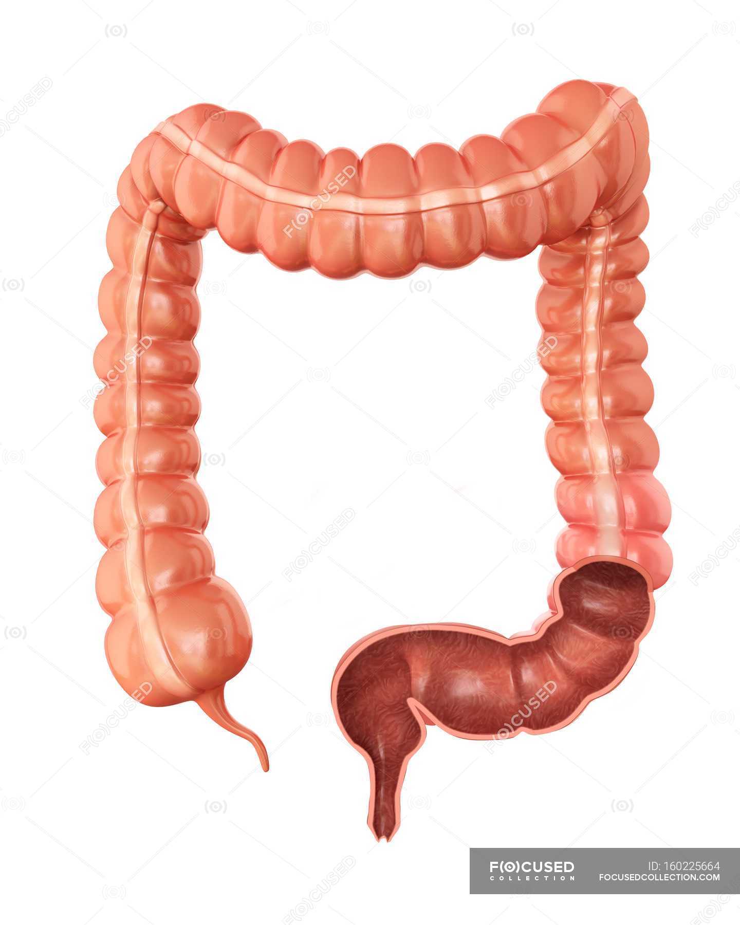 Мегаколон болезнь гиршпрунга. Мегаколон прямой кишки. Для идиопатического мегаколон характерно. Мегаколон у детей кишечник. Для идиопатического мегаколон характерно.