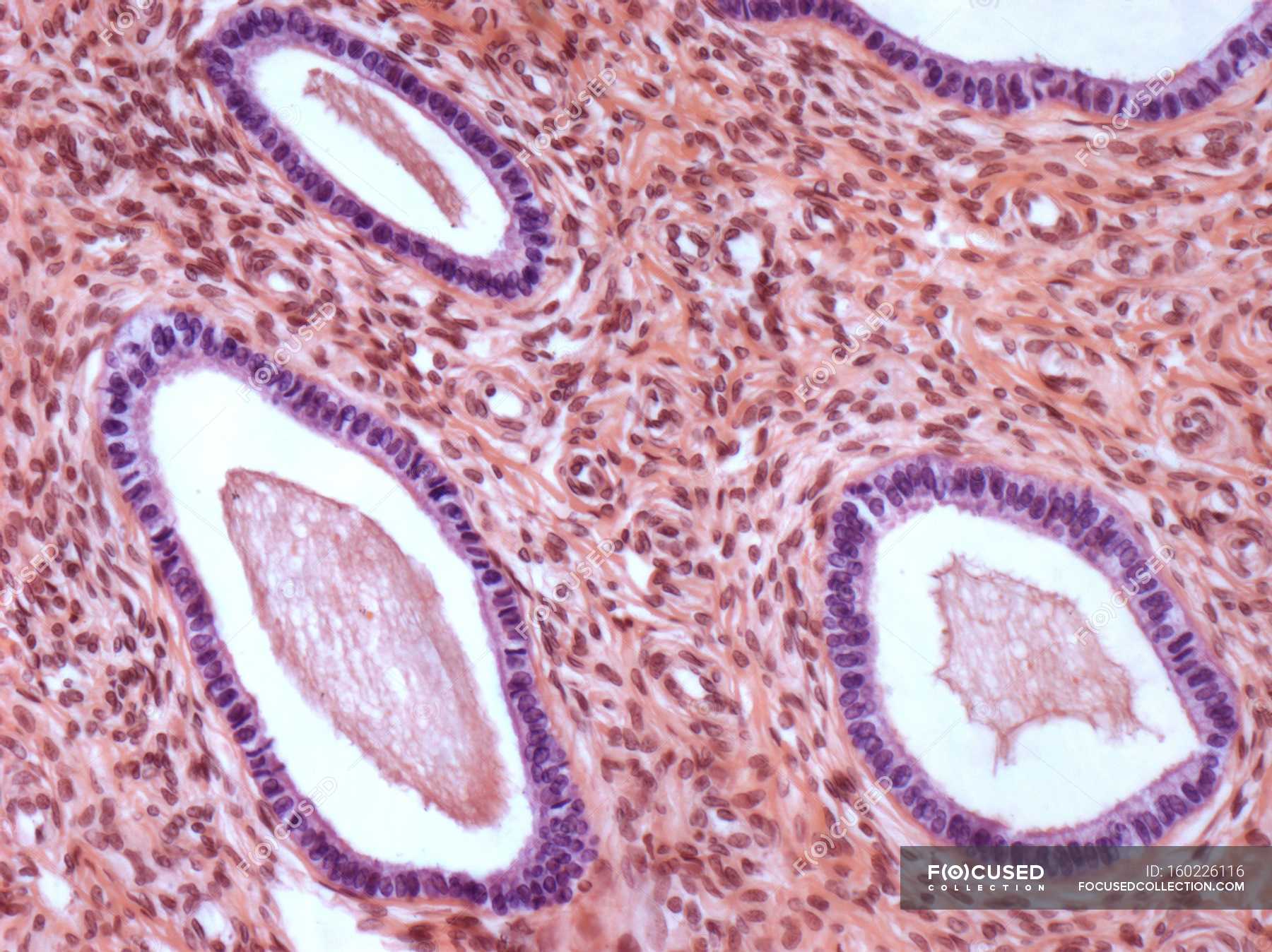 Mucosa Structure Of The Cervix — Cervical, Light - Stock Photo | #160226116