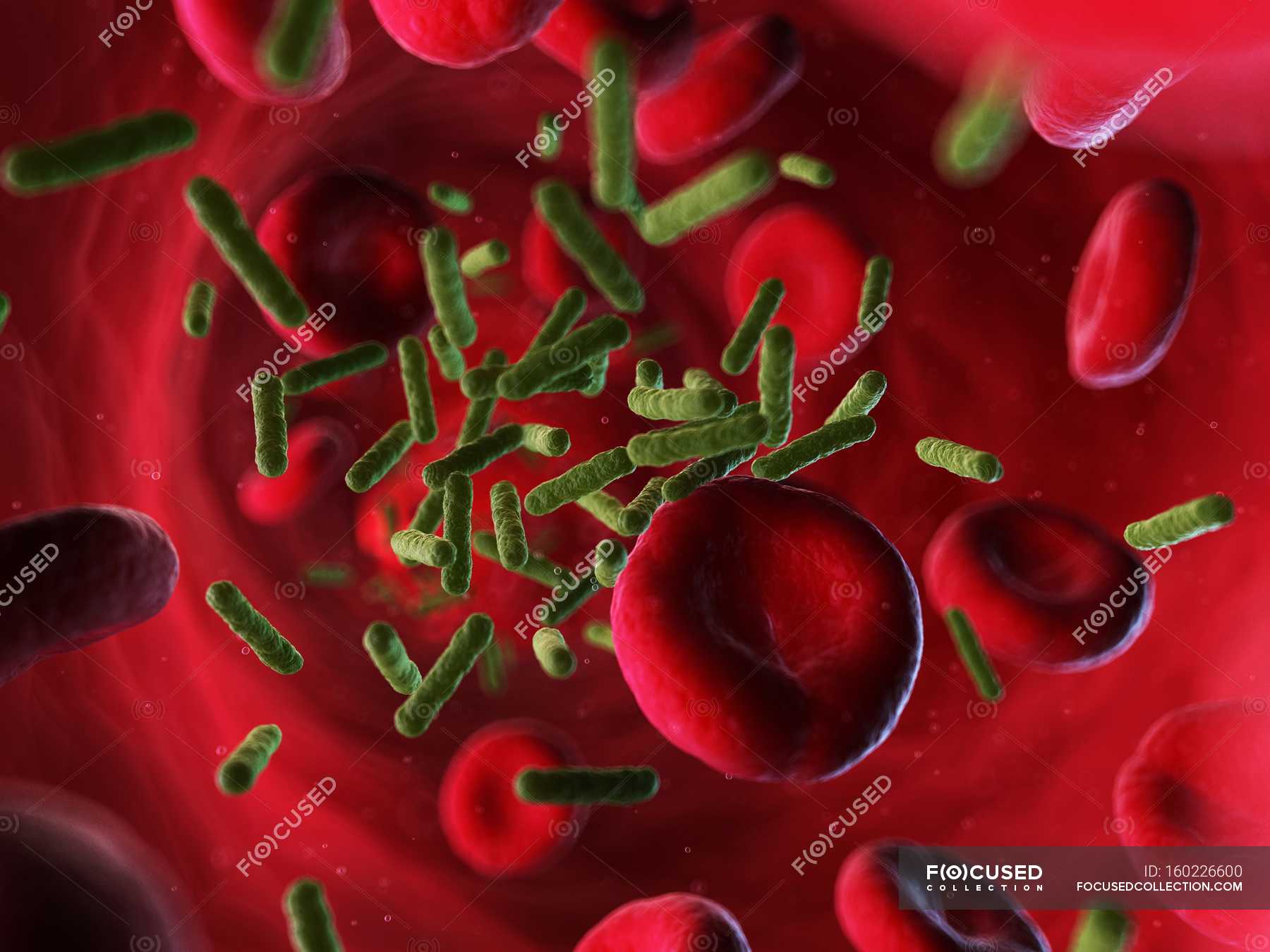 Bacterial Pathogens Stock Photos Royalty Free Images Focused   Focused 160226600 Stock Photo Bacterial Infection Spreading In Bloodstream 