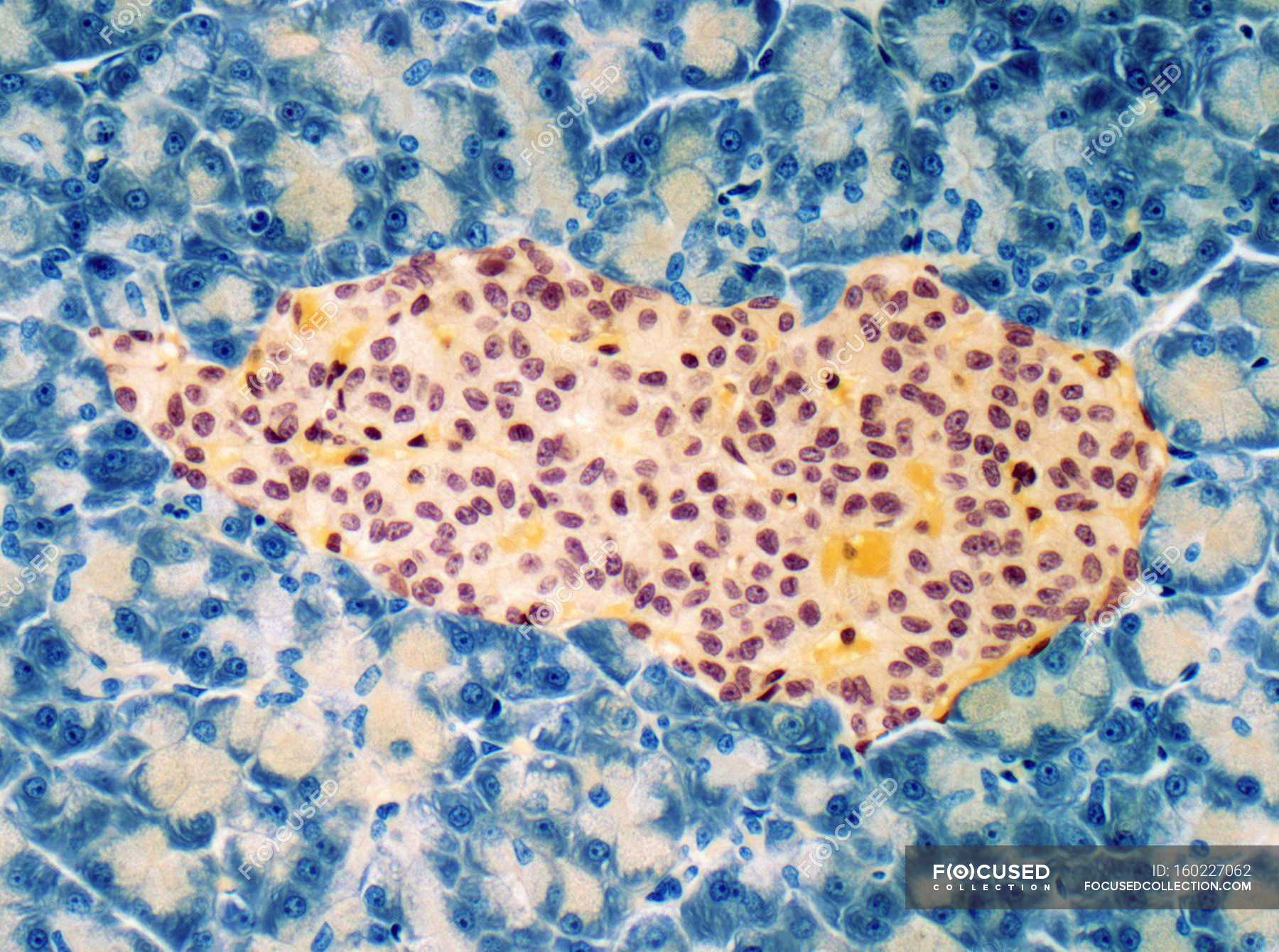 Structure Of Islet Of Langerhans Light Micrograph Organ Photomicrograph Stock Photo