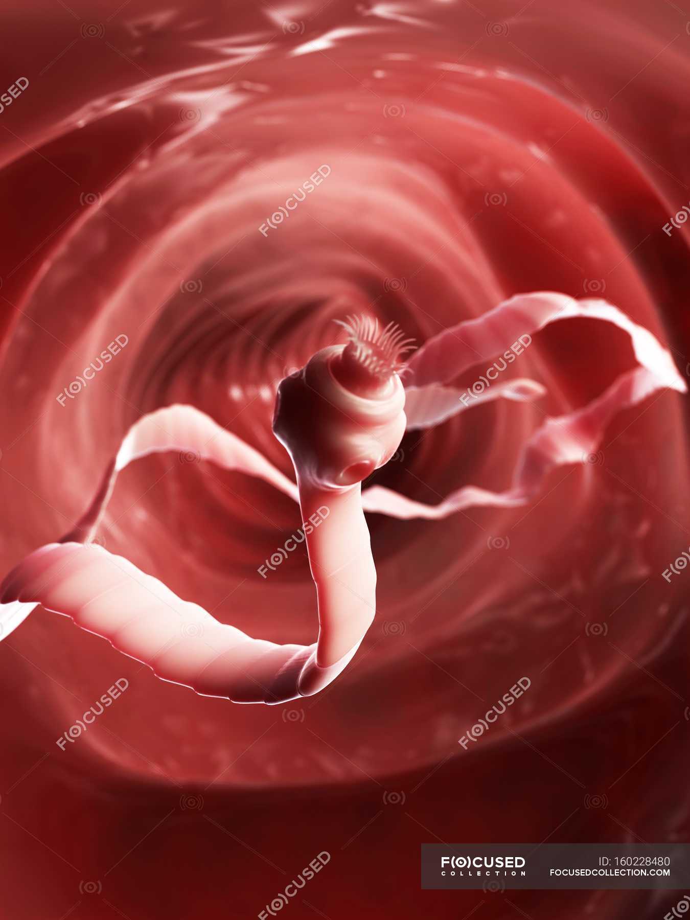 tapeworm-parasites-in-intestines-digestion-biomedical-illustration