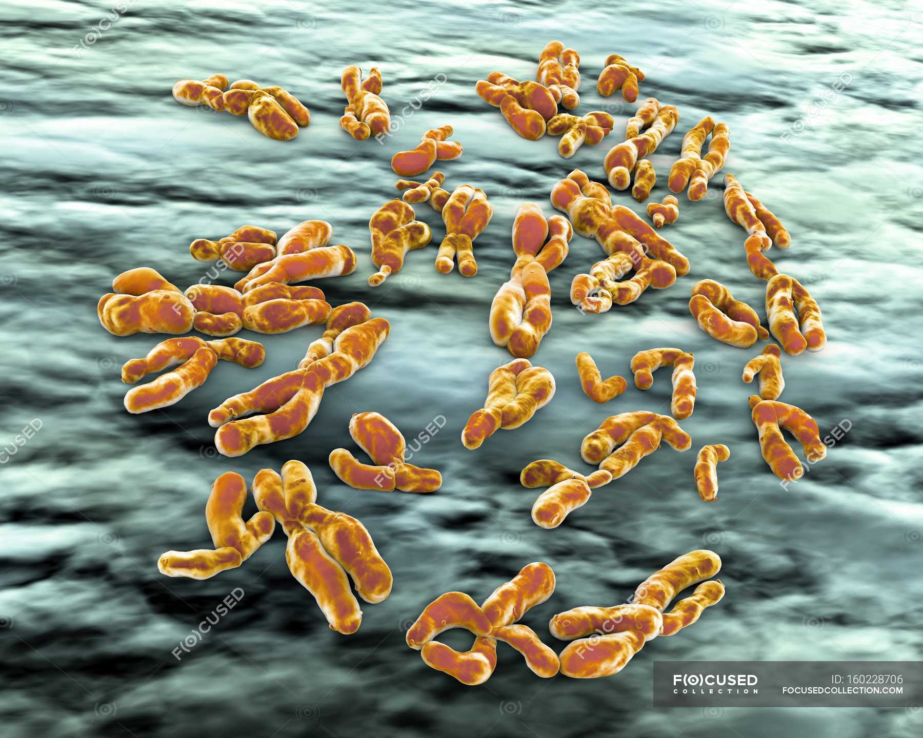 Normale menschliche Chromosomen — Differenzialfokus, x Chromosom