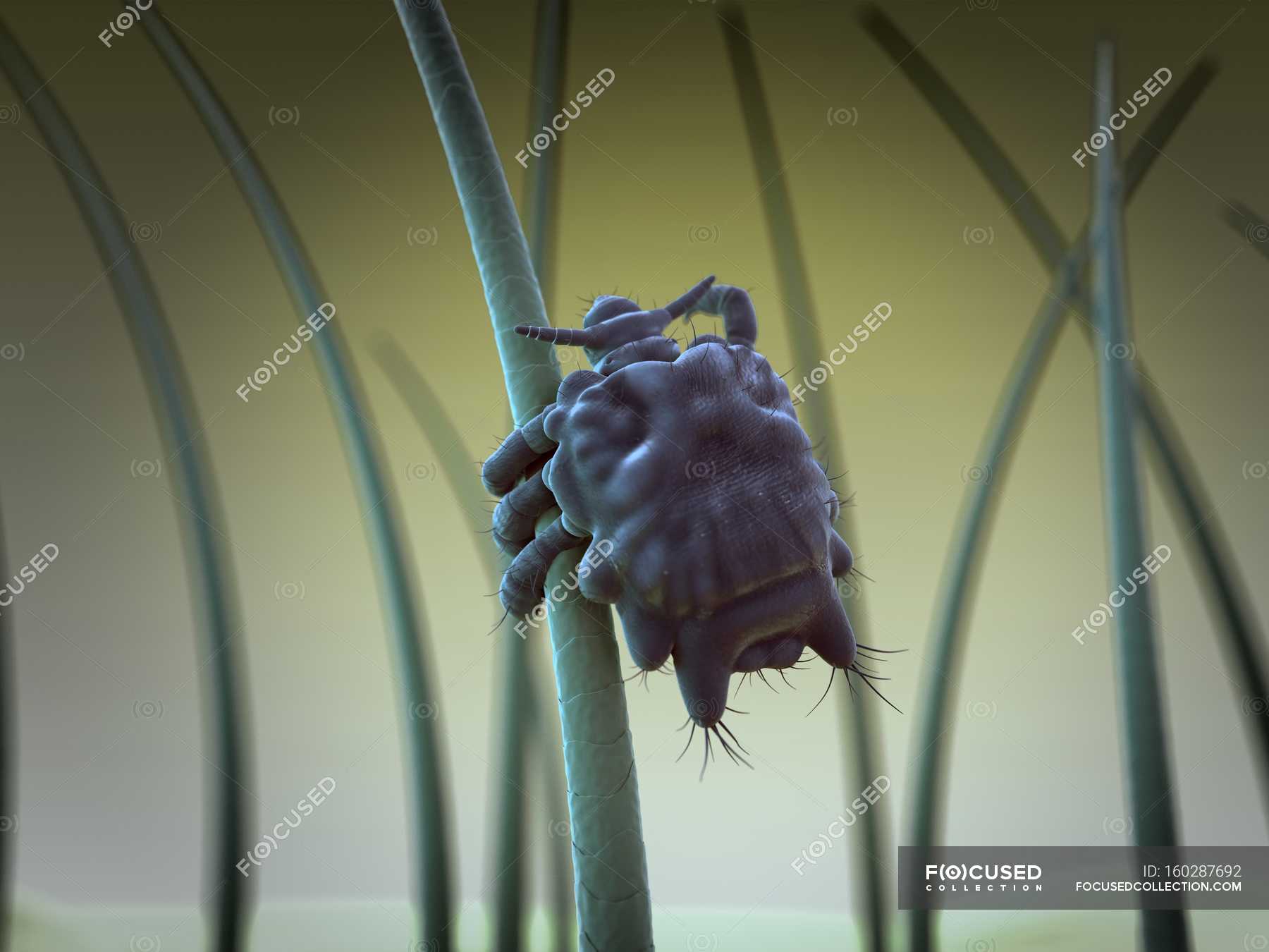 Adult Pubic Louse On Hair Pubic Hair Computer Artwork Stock
