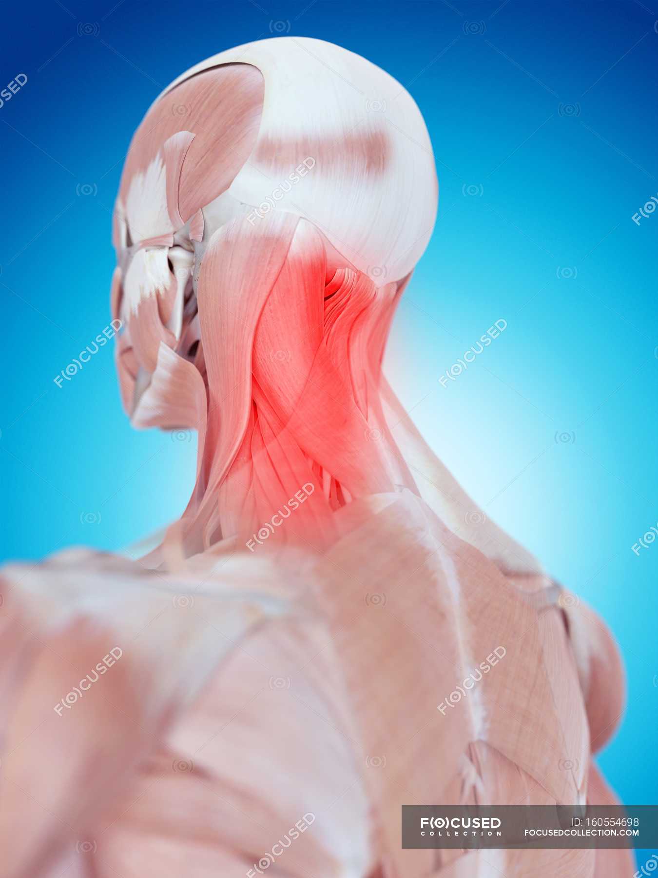 Neck Pain Affecting Head