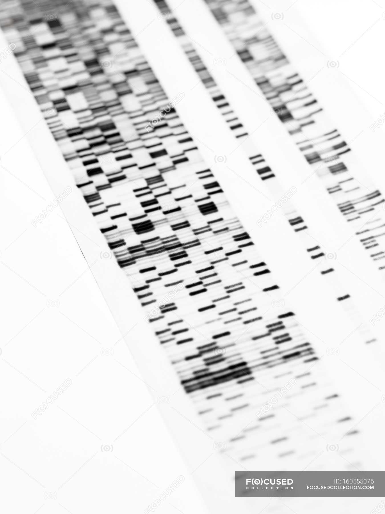 Closeup of DNA autoradiogram on white background. —
