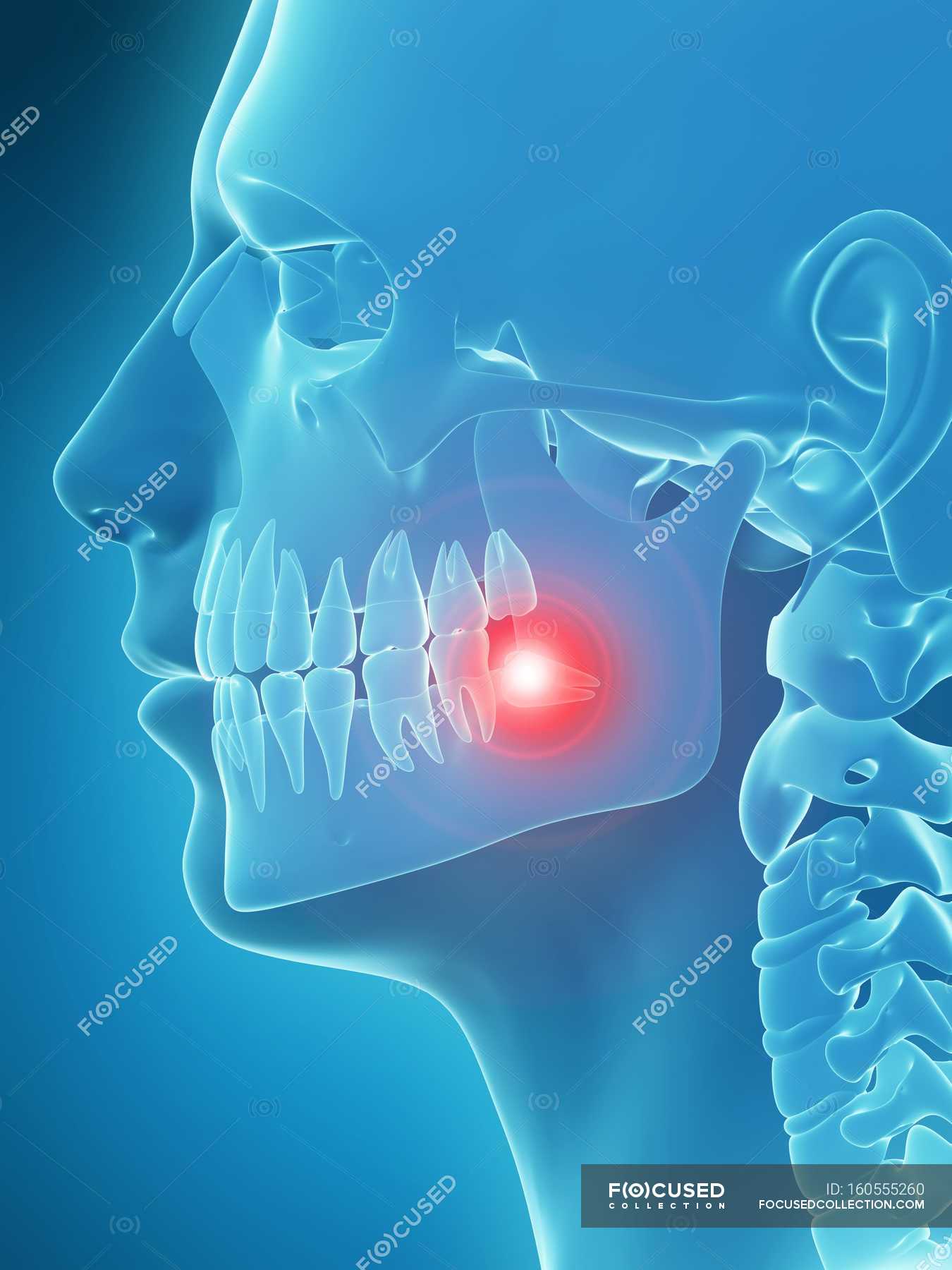 tooth-pain-visualization-sore-medical-illustration-stock-photo