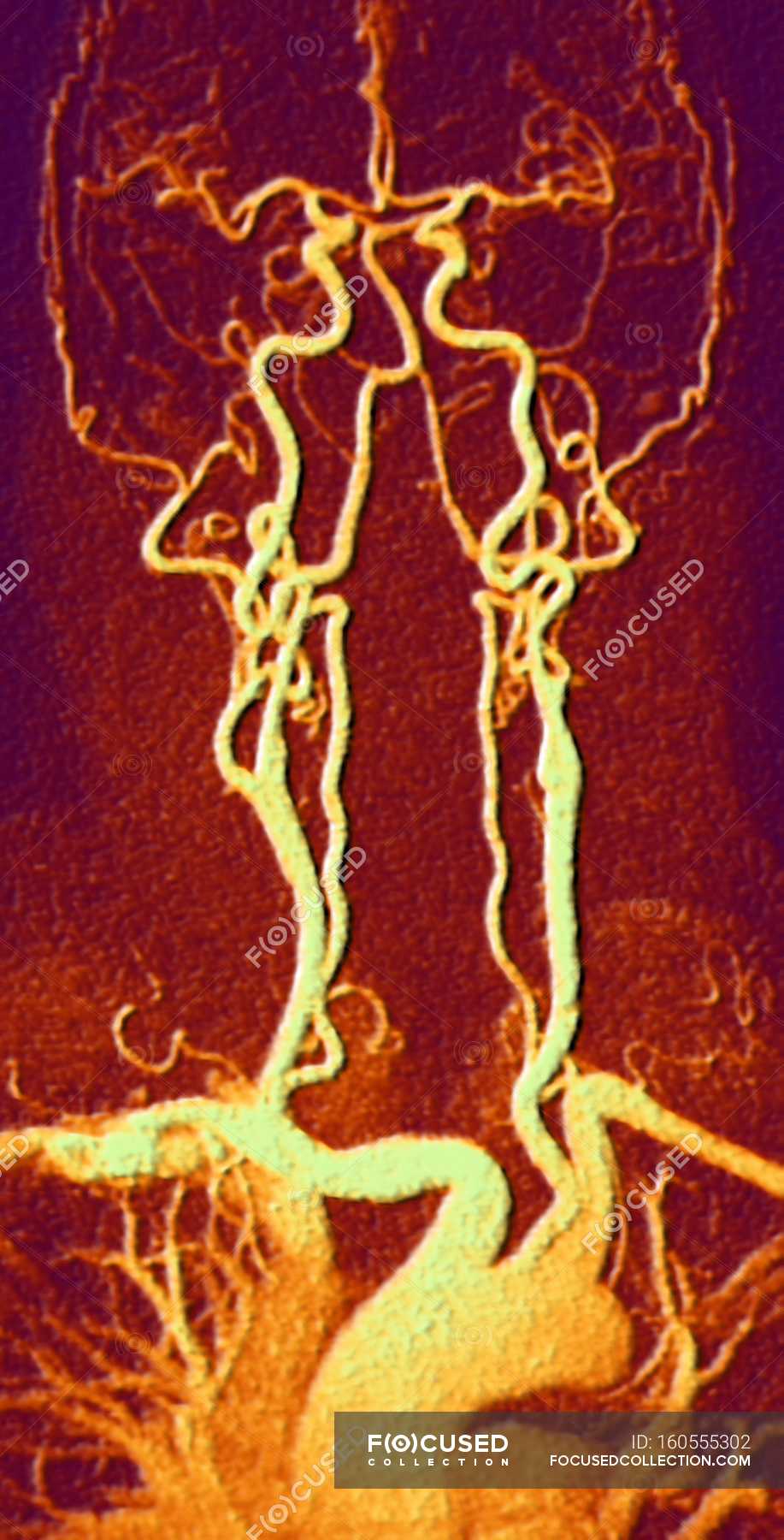 coloured-magnetic-resonance-angiography-stock-photos-royalty-free