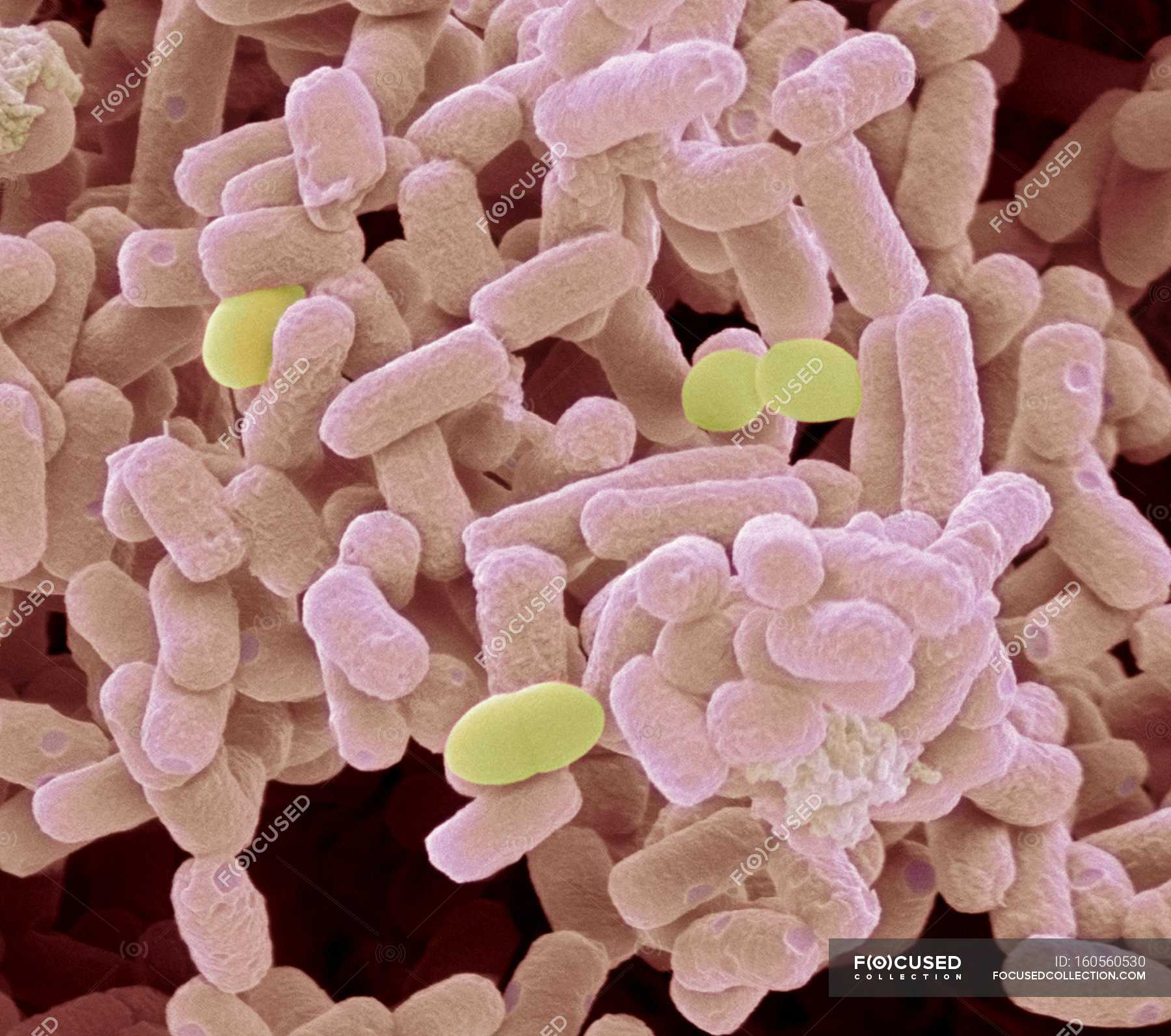 Escherichia coli bacteria — microbiology, bacterial pathogen - Stock ...