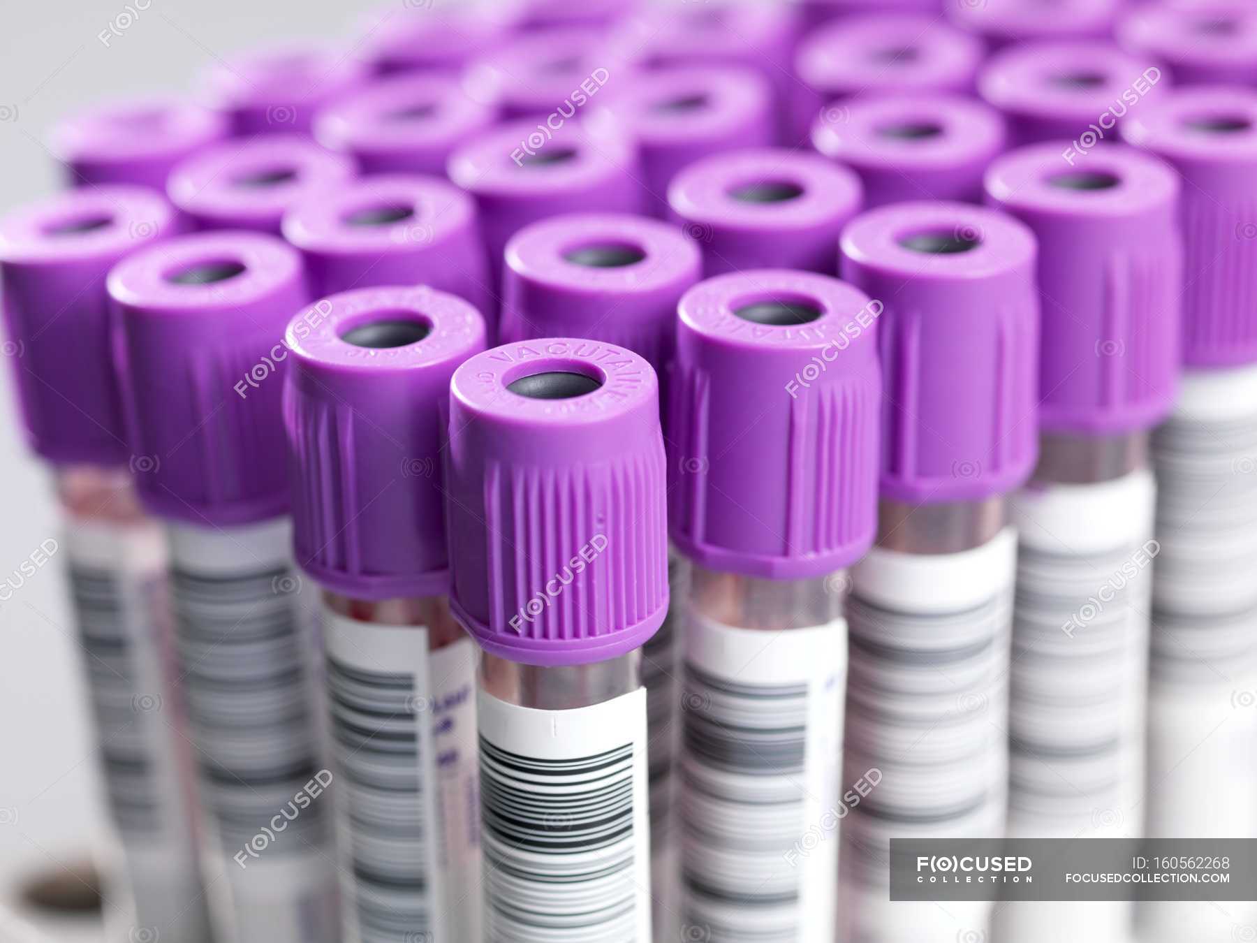 labelled-vacutainer-tubes-containing-blood-samples-close-up