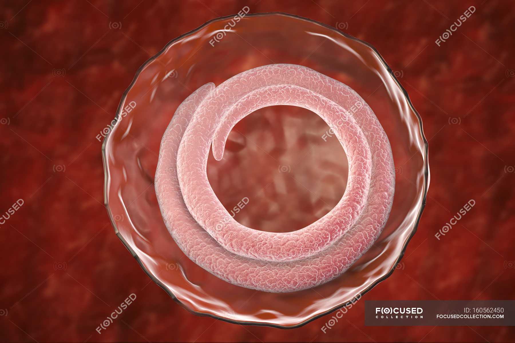 trichina-spiralis-roundworm-muscle-parasite-wildlife-stock-photo