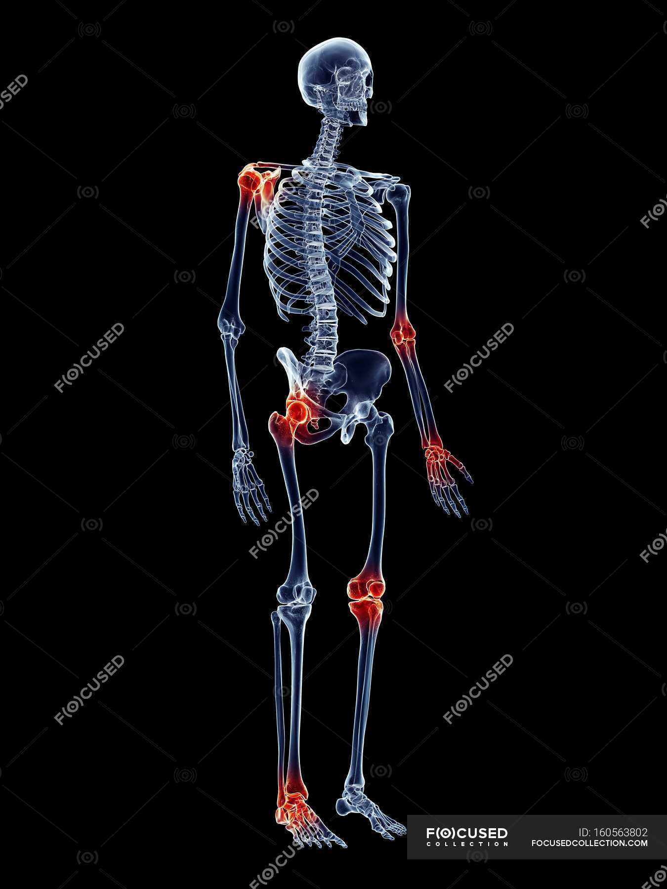 Shoulder and waist joints pain — no one, details - Stock Photo | #160563802