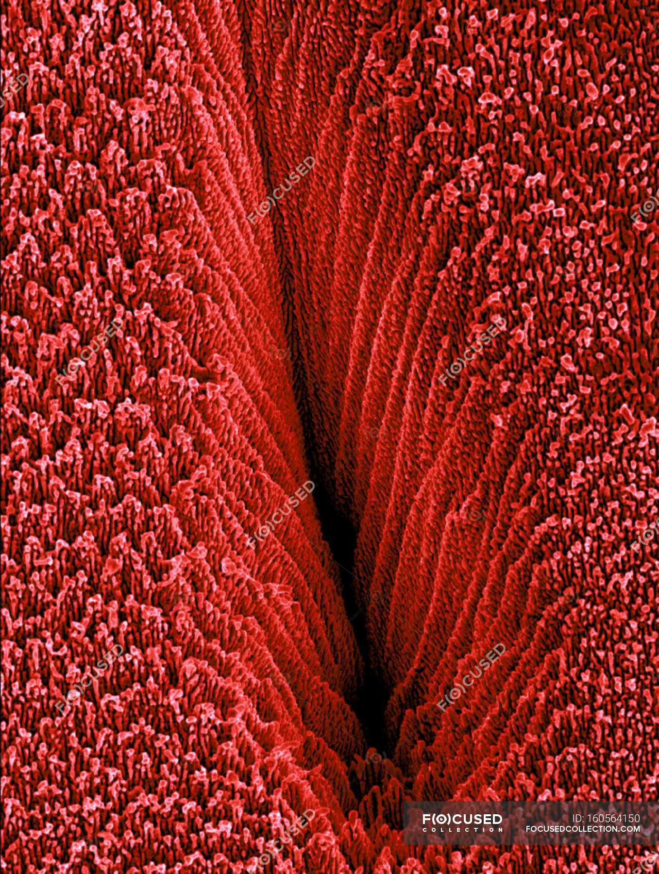 Pit formed on metal or semiconductor surface — laser physics, laser ...