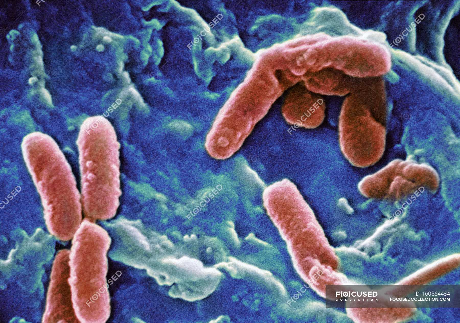 Pseudomonas aeruginosa Bakterien — Details, Medizin Stock Photo