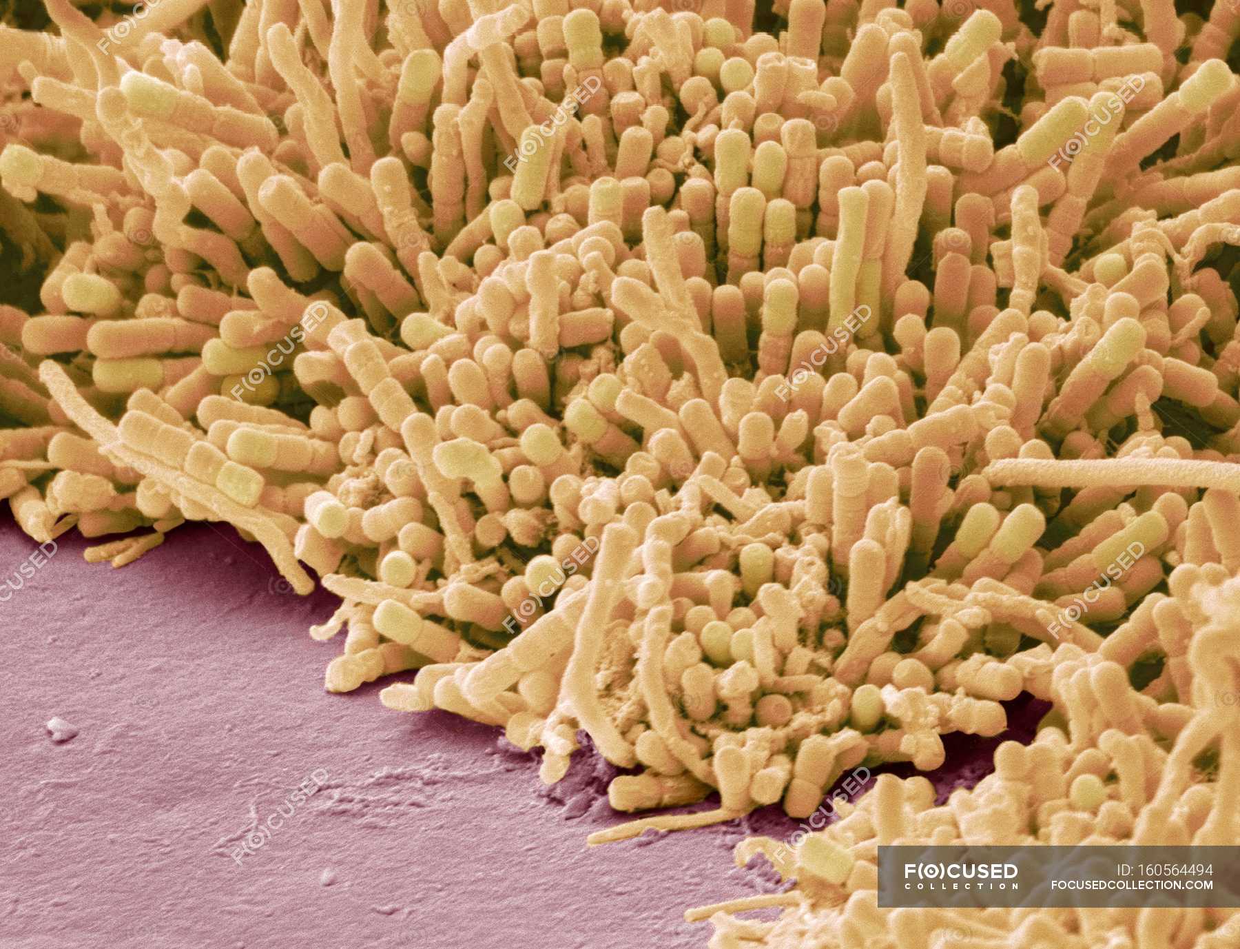 Plaqueforming bacteria — bacterium, Stock Photo 160564494