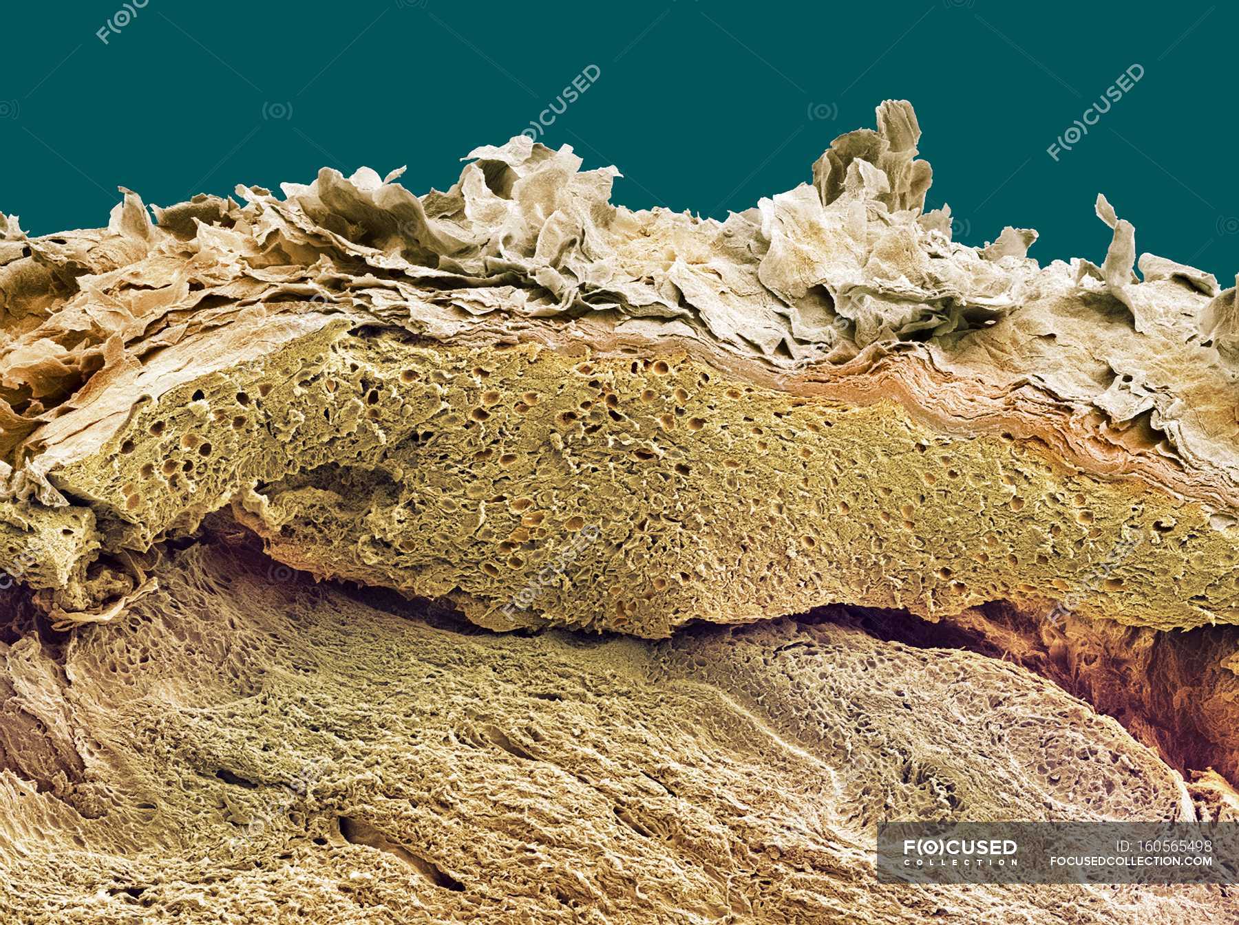 Coloured Scanning Electron Micrograph Sem Of A Section Through